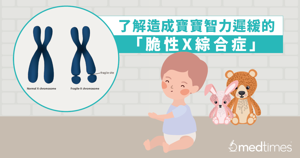 【遗传疾病】了解造成宝宝智力迟缓的「脆性X综合症」